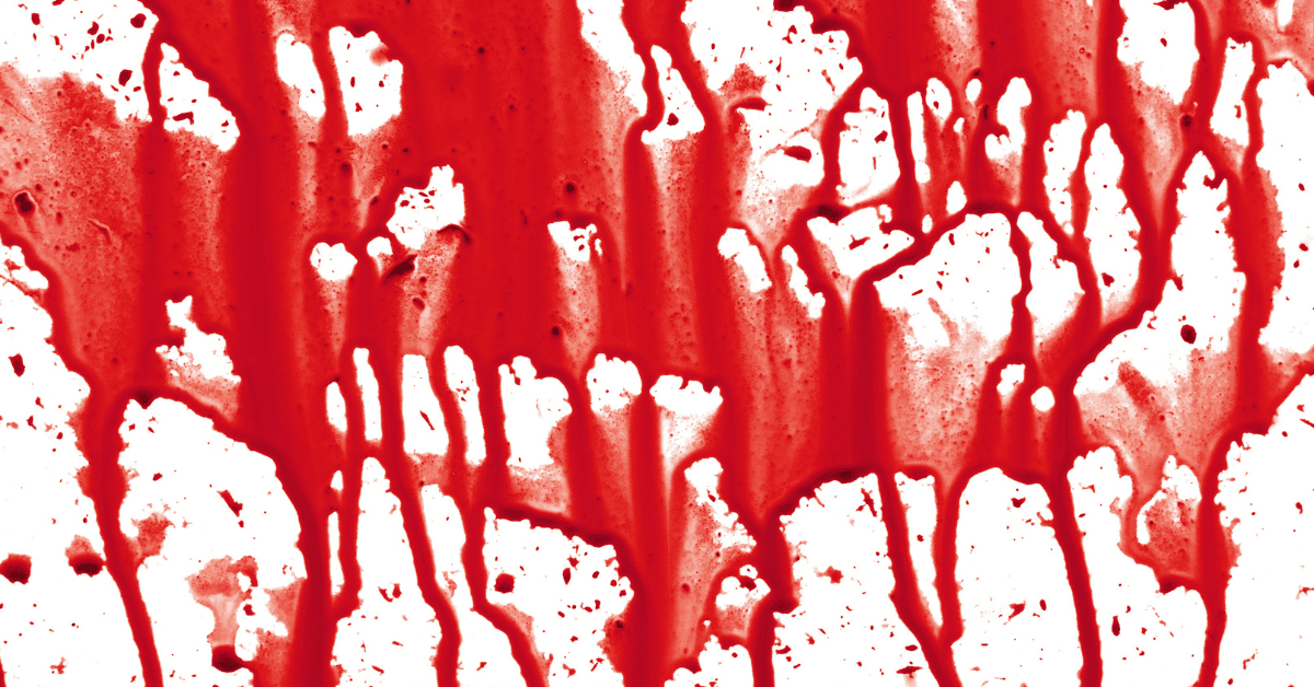 Upper vs. Lower GI Bleeds: What the Color Tells You and Why It Changes Your Approach